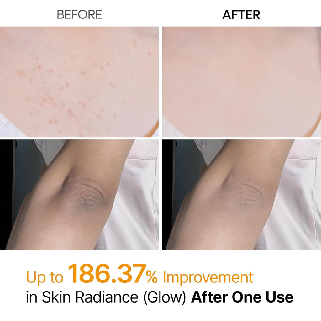 Dr. Melaxin Peel Shot Exfoliating Kojic Acid Turmeric Spray